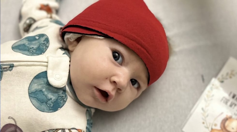 Diana Strohm received a cochlear implant in a surgery that had only ever been tried once...